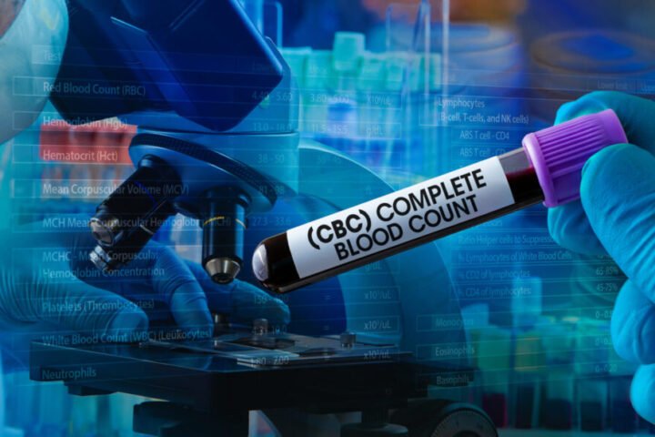 CBC test normal range