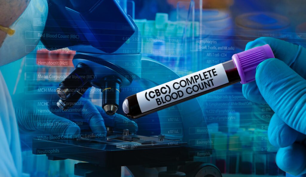 CBC test normal range