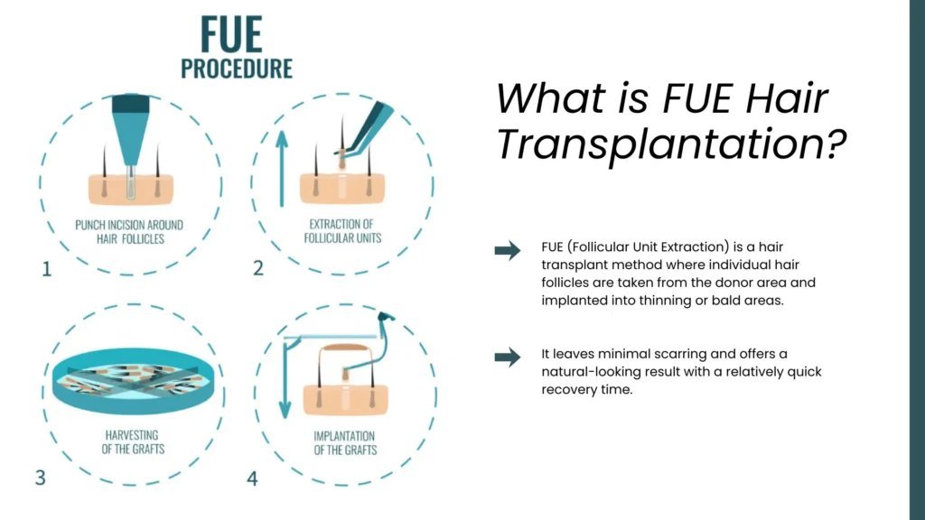 the cost of hair replacement